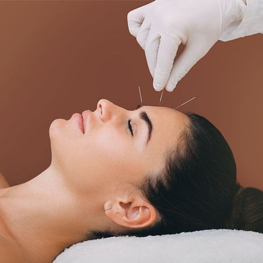 ¿Cómo ayuda la acupuntura en la menopausia?