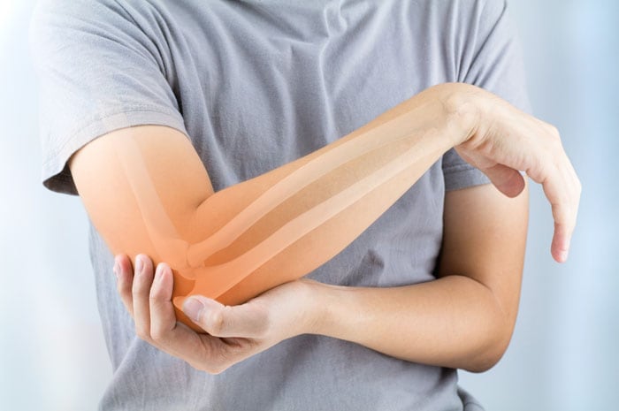 Osteoporosis y menopausia